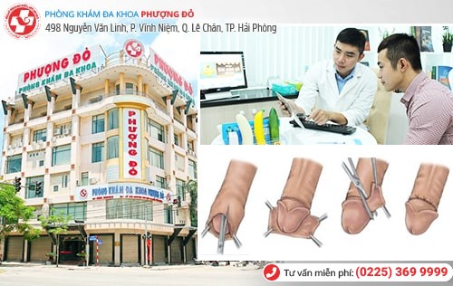 Chi Phí Cắt Bao Quy Đầu Ở Hải Phòng Bao Nhiêu Tiền?