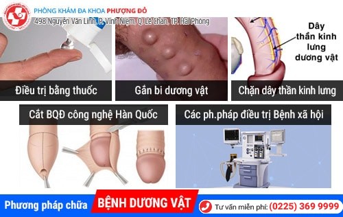 Bệnh dương vật là gì? Cách chữa trị hiệu quả hiện nay