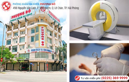 Điều trị cặn trắng đầu dương vật