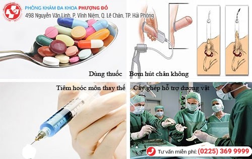 Phương pháp chữa rối loạn chức năng cương dương hiệu quả