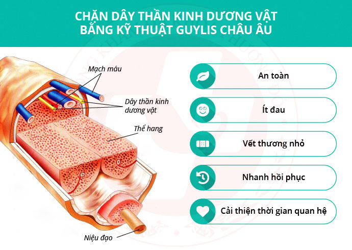 Hãm xuất tinh bằng kỹ thuật Guylis