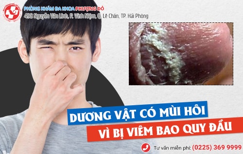 Tại sao dương vật có mùi hôi