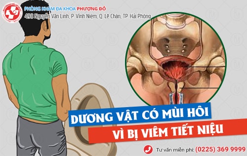 Tại sao dương vật có mùi hôi