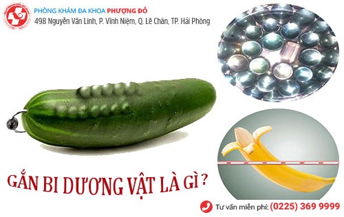 Gắn bi vào dương vật là gì?