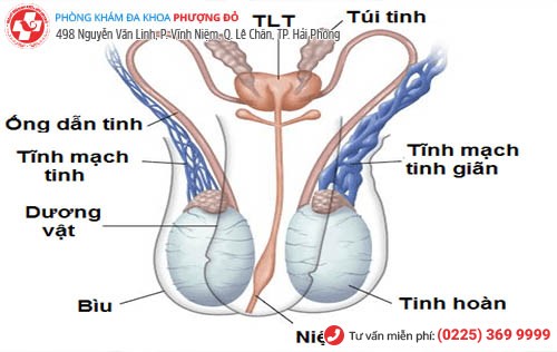 giãn tĩnh mạch thừng tinh 