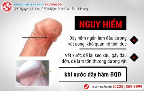 Xước dây hãm quy đầu là bị sao? Có chữa được không?