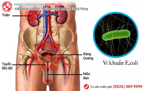 viêm đường tiết niệu nam