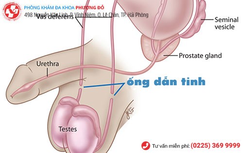 Hình ảnh ống dẫn tinh