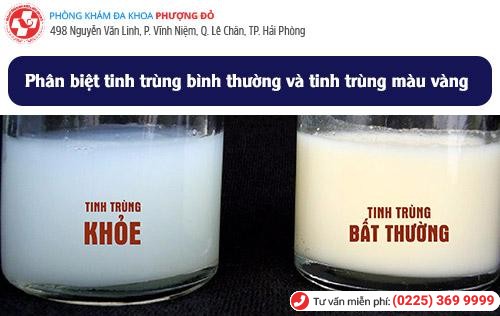 Hoang mang khi phát hiện tinh trùng màu vàng