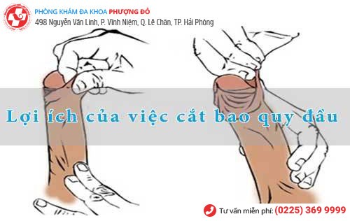 Tiểu phẫu bao quy đầu nhỏ nhưng mang lại nhiều lợi ích