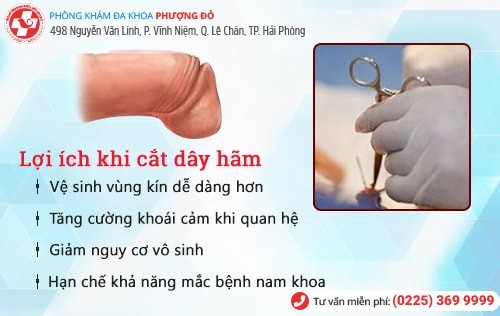 Nên cắt dây hãm quy đầu khi nào? Giải đáp chi tiết bác sĩ chuyên khoa