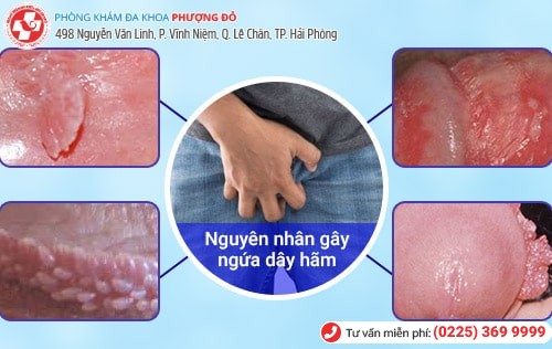 Ngứa dây hãm bao quy đầu là bệnh gì?