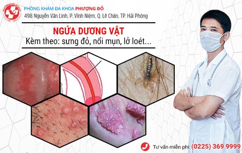 Bạn có gặp rắc rối với tình trạng ngứa dương vật?