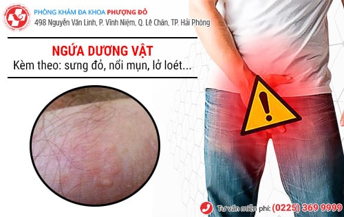 Bạn có gặp rắc rối với tình trạng ngứa dương vật?