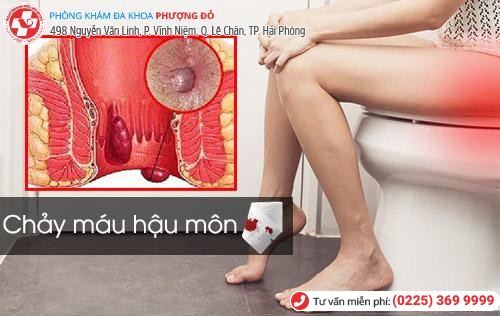 Nguy hiểm rình rập khi bị chảy máu hậu môn