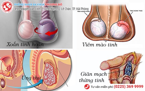 nguyên nhân đau tinh hoàn trái