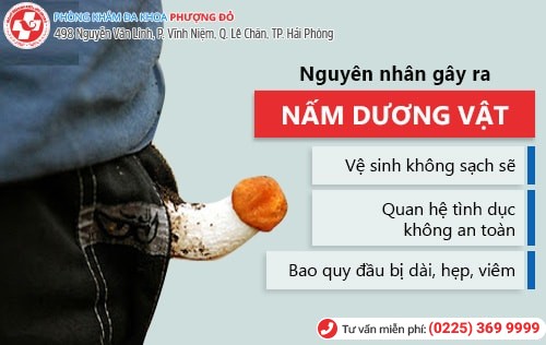 Bệnh nấm dương vật là gì?