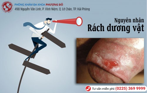 Rách dương vật