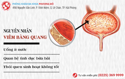 Nguyên nhân viêm bàng quang