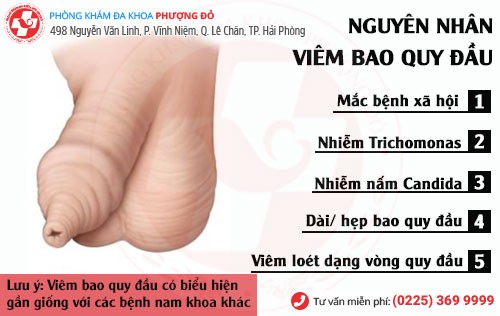 Nguyên nhân viêm bao quy đầu