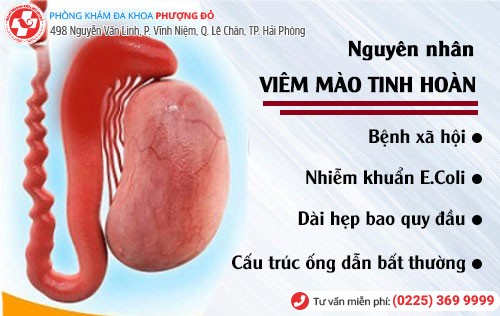 Nguyên nhân viêm mào tinh hoàn