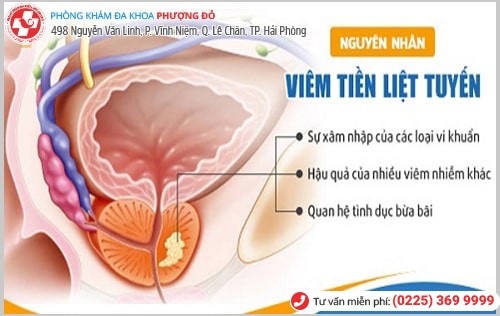 Tỷ lệ mắc viêm tuyến tiền liệt ngày càng trẻ hóa