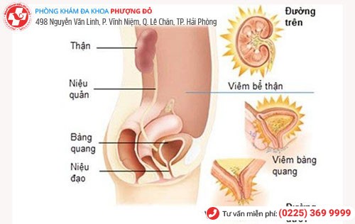 Nhiễm trùng đường tiểu khiến bệnh nhân đi tiểu không được