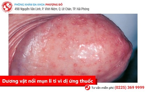 Nỗi đau thầm kín mang tên xuất tinh sớm