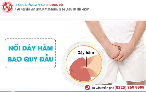 Phương pháp nối dây hãm quy đầu