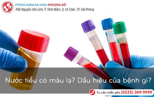 Nước tiểu đột nhiên có màu lạ có sao không?