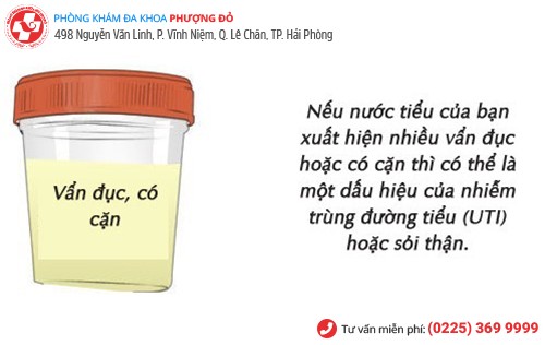 Nước tiểu vẩn đục, có cặn