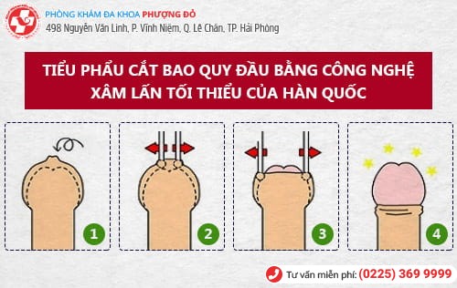 Ở Hải Phòng nên cắt bao quy đầu ở đâu?