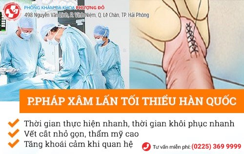 Tổng quan dây hãm bao quy đầu nam giới nên biết