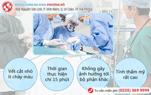 Trường hợp nào cần nối dây hãm quy đầu? Phương pháp nối dây hãm an toàn