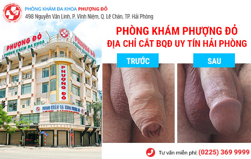 hình ảnh trước và sau cắt bao quy đầu