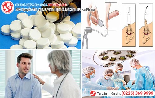 phương pháp điều trị liệt dương