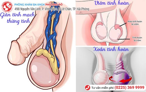 Các bệnh gây sa tinh hoàn