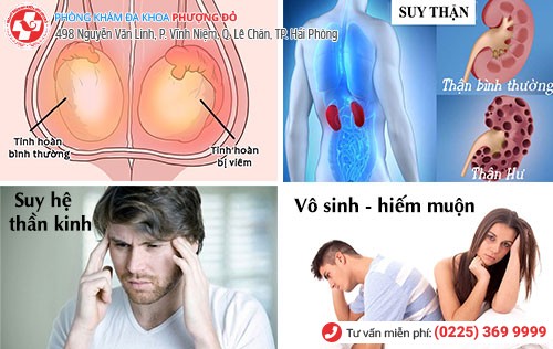 viêm tuyến tiền liệt gây vô sinh