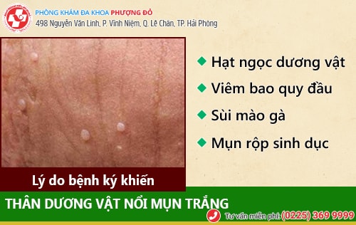 Hé lộ: Vì sao thân dương vật nổi mụn trắng