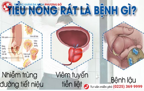 Tiểu nóng rát là dấu hiệu nhiều bệnh nguy hiểm