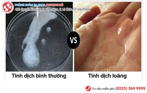 Tinh dịch bình thường có màu trắng đục