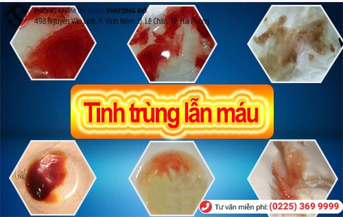 Tinh trùng lẫn máu do nhiều nguyên nhân khác nhau gây nên