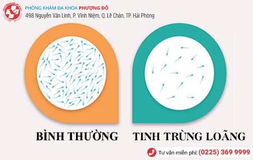 Tinh trùng loãng ở nam giới