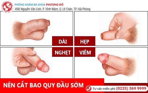 Những lợi ích cắt bao quy đầu đối với sức khỏe nam giới