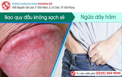 Ngứa dây hãm bao quy đầu là bệnh gì?