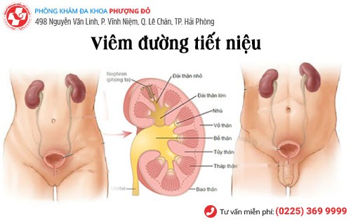 Viêm đường tiết niệu