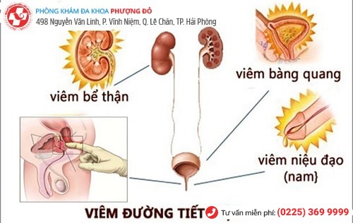 Vi khuẩn E.coli là nguyên nhân chính khiến đường tiểu bị viêm