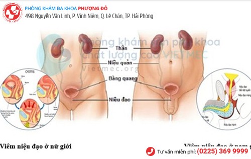 Viêm niệu đạo ở nam và nữ