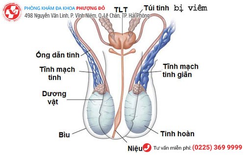 Hình ảnh túi tinh bị viêm