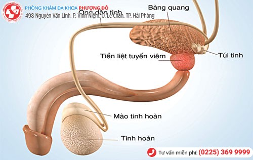 biểu hiện viêm tuyến tiền liệt